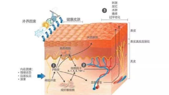 陽(yáng)泉市“屏障修復(fù)”修復(fù)的是什么？不同膚質(zhì)該如何搭配？